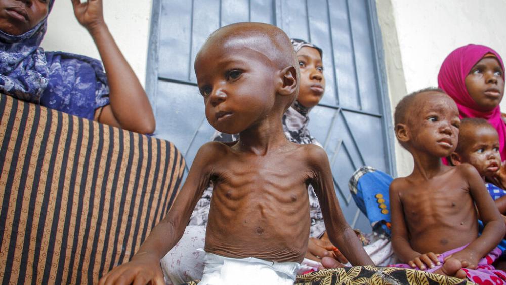 starving little boy - famine in Somalia