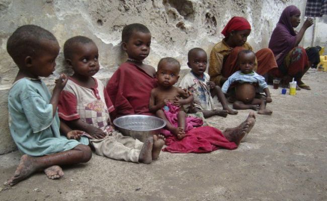 starving children in Somalia