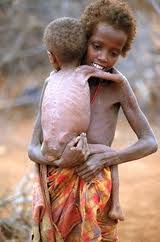 Starving children